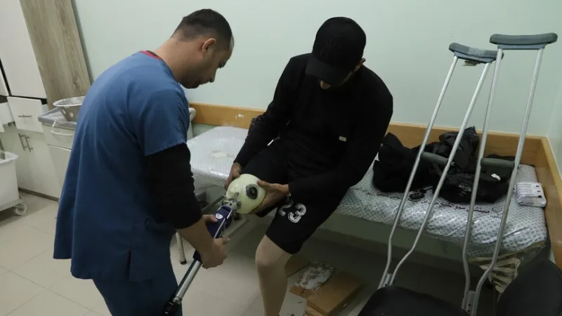 В Газа, която е под израелска блокада, палестинците чакат с месеци, за да получат протези